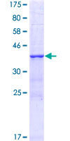ab159934 on a 12.5% SDS-PAGE stained with Coomassie Blue.