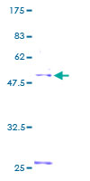 ab153526 on a 12.5% SDS-PAGE stained with Coomassie Blue.