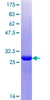 ab163353 on a 12.5% SDS-PAGE stained with Coomassie Blue.