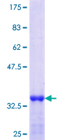 ab163550 on a 12.5% SDS-PAGE stained with Coomassie Blue.