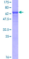 ab163915 on a 12.5% SDS-PAGE stained with Coomassie Blue.