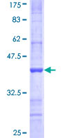 ab160446 on a 12.5% SDS-PAGE stained with Coomassie Blue.