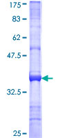 ab163848 on a 12.5% SDS-PAGE stained with Coomassie Blue.