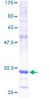 ab158959 on a 12.5% SDS-PAGE stained with Coomassie Blue.