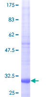 ab158960 on a 12.5% SDS-PAGE stained with Coomassie Blue.