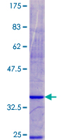 ab158961 on a 12.5% SDS-PAGE stained with Coomassie Blue.