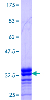 ab158966 on a 12.5% SDS-PAGE stained with Coomassie Blue.