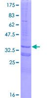ab158976 on a 12.5% SDS-PAGE stained with Coomassie Blue.