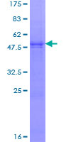 ab158982 on a 12.5% SDS-PAGE stained with Coomassie Blue.
