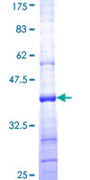ab158983 on a 12.5% SDS-PAGE stained with Coomassie Blue.