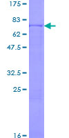 ab158977 on a 12.5% SDS-PAGE stained with Coomassie Blue.