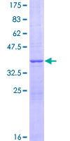 ab158984 on a 12.5% SDS-PAGE stained with Coomassie Blue.
