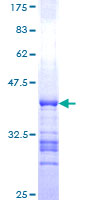 ab158985 on a 12.5% SDS-PAGE stained with Coomassie Blue.