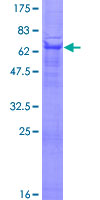 ab153257 on a 12.5% SDS-PAGE stained with Coomassie Blue.