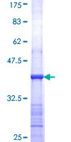 ab153258 on a 12.5% SDS-PAGE stained with Coomassie Blue.