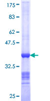 ab153590 on a 12.5% SDS-PAGE stained with Coomassie Blue.