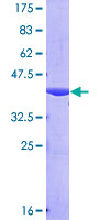 ab153216 on a 12.5% SDS-PAGE stained with Coomassie Blue.