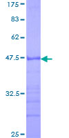 ab163576 on a 12.5% SDS-PAGE stained with Coomassie Blue.