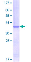ab166077 on a 12.5% SDS-PAGE stained with Coomassie Blue.