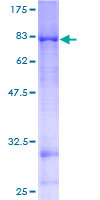 ab164139 on a 12.5% SDS-PAGE stained with Coomassie Blue.