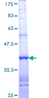 ab164140 on a 12.5% SDS-PAGE stained with Coomassie Blue.