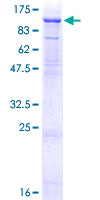 ab166159 on a 12.5% SDS-PAGE stained with Coomassie Blue.