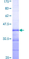 ab166160 on a 12.5% SDS-PAGE stained with Coomassie Blue.