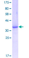 ab153569 on a 12.5% SDS-PAGE stained with Coomassie Blue.