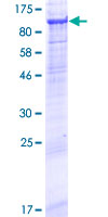 ab164012 on a 12.5% SDS-PAGE stained with Coomassie Blue.