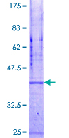 ab160922 on a 12.5% SDS-PAGE stained with Coomassie Blue.