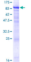ab164366 on a 12.5% SDS-PAGE stained with Coomassie Blue.