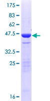 ab164364 on a 12.5% SDS-PAGE stained with Coomassie Blue.