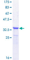 ab164365 on a 12.5% SDS-PAGE stained with Coomassie Blue.
