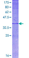 ab152983 on a 12.5% SDS-PAGE stained with Coomassie Blue.