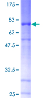 ab161442 on a 12.5% SDS-PAGE stained with Coomassie Blue.
