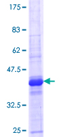 ab153462 on a 12.5% SDS-PAGE stained with Coomassie Blue.