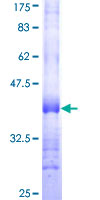 ab164622 on a 12.5% SDS-PAGE stained with Coomassie Blue.