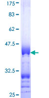 ab163141 on a 12.5% SDS-PAGE stained with Coomassie Blue.