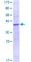 ab160463 on a 12.5% SDS-PAGE stained with Coomassie Blue.