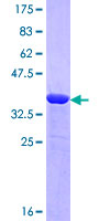 ab162045 on a 12.5% SDS-PAGE stained with Coomassie Blue.