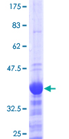 ab153479 on a 12.5% SDS-PAGE stained with Coomassie Blue.