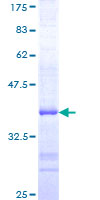 ab161105 on a 12.5% SDS-PAGE stained with Coomassie Blue.