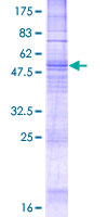 12.5% SDS-PAGE analysis of ab152721 stained with Coomassie Blue.