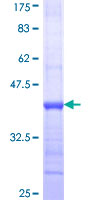 ab161450 on a 12.5% SDS-PAGE stained with Coomassie Blue.