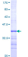 ab162733 on a 12.5% SDS-PAGE stained with Coomassie Blue.