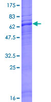 ab161719 on a 12.5% SDS-PAGE stained with Coomassie Blue.