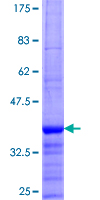 ab160050 on a 12.5% SDS-PAGE stained with Coomassie Blue.