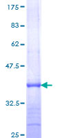 ab158345 on a 12.5% SDS-PAGE stained with Coomassie Blue.