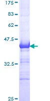 ab158989 on a 12.5% SDS-PAGE stained with Coomassie Blue.
