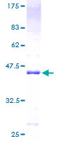 ab164685 on a 12.5% SDS-PAGE stained with Coomassie Blue.